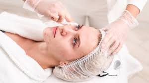 Acne Solutions: Effective Treatments for Clear and Healthy Skin