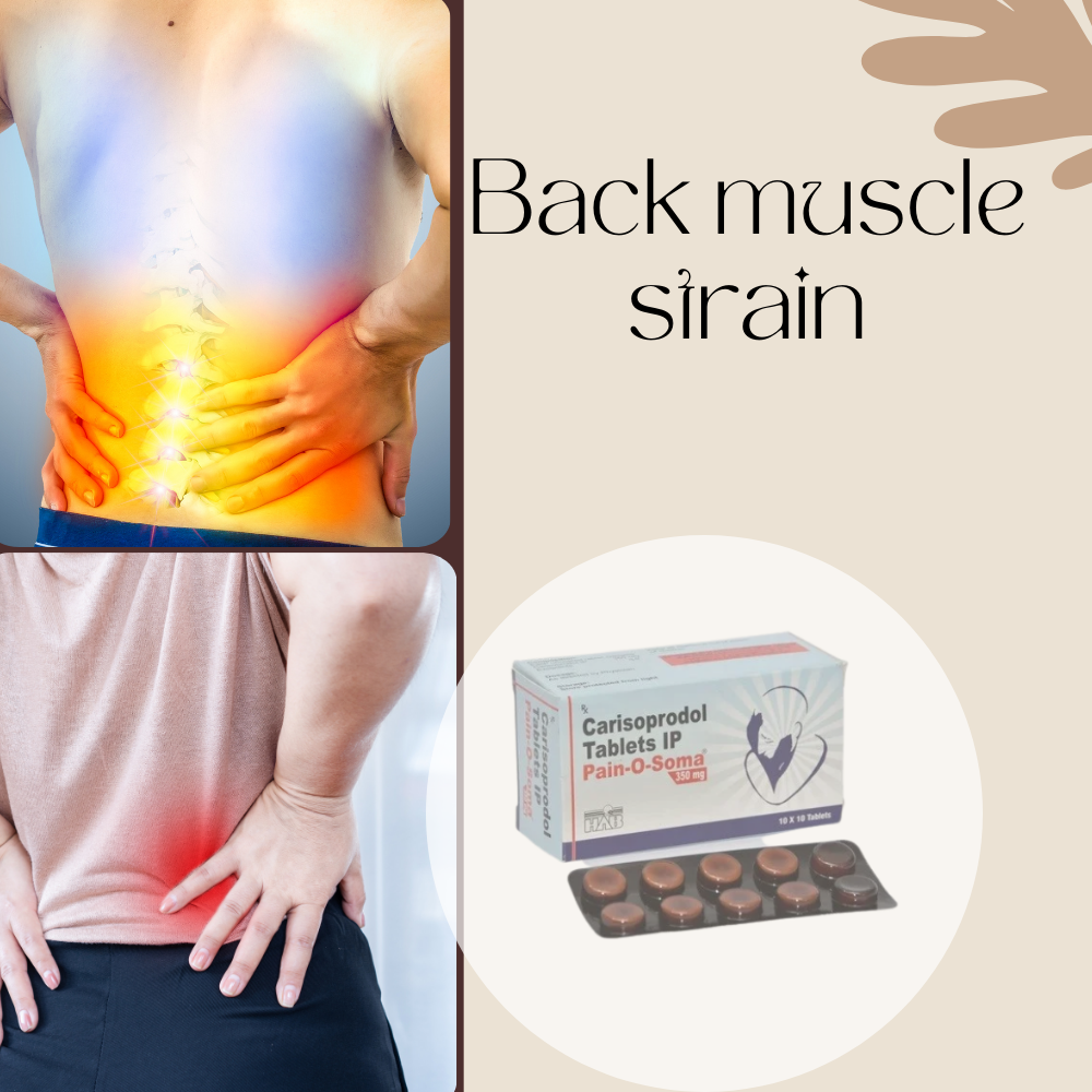 manage back muscle strain with pain o soma