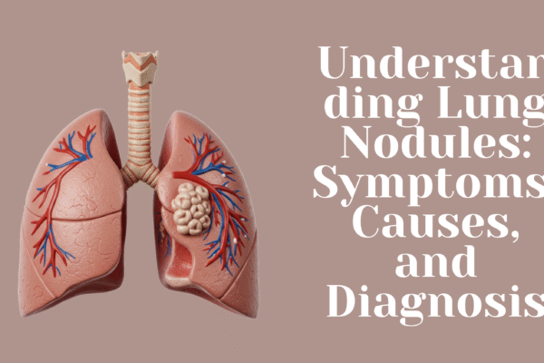 Understanding Lung Nodules: Symptoms, Causes, and Diagnosis Understanding Lung Nodules: Symptoms, Causes, and Diagnosis