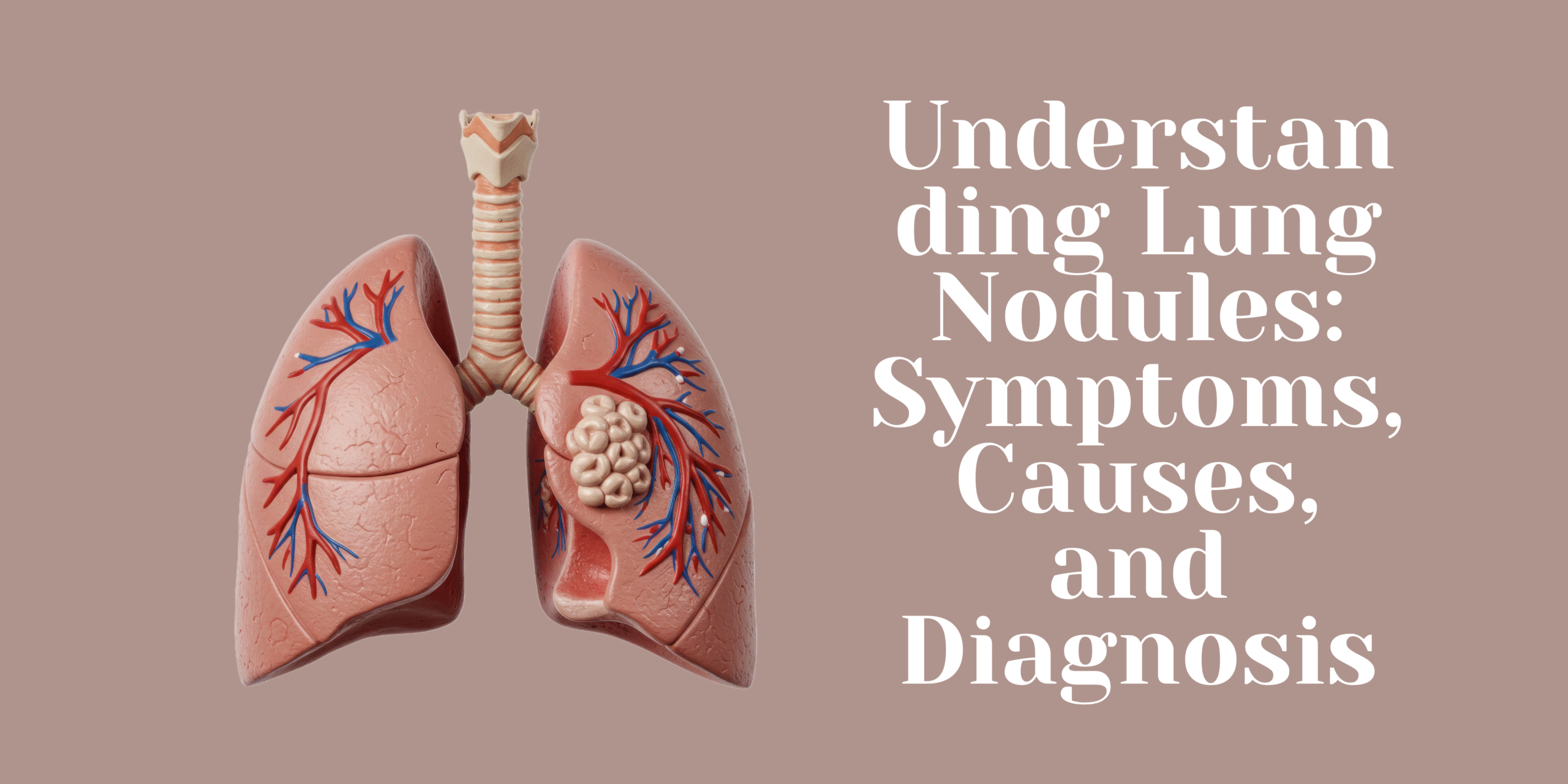 Understanding Lung Nodules: Symptoms, Causes, and Diagnosis