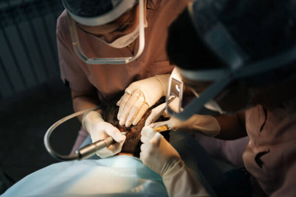From Beard to Crown: Expanding Donor Options in Hair Transplant in Riyadh Hair Transplant in Riyadh