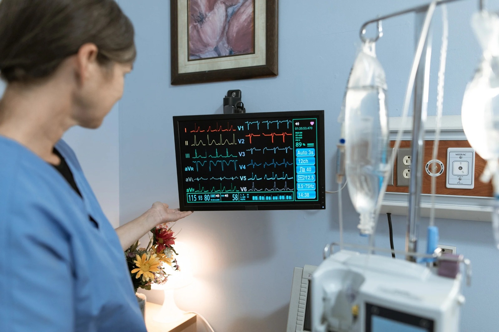 ECG Test Price in Bangalore